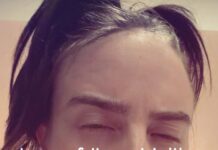 Billie Eilish, Olivia Rodrigo… denuncian el asesinato de Alex Pretti